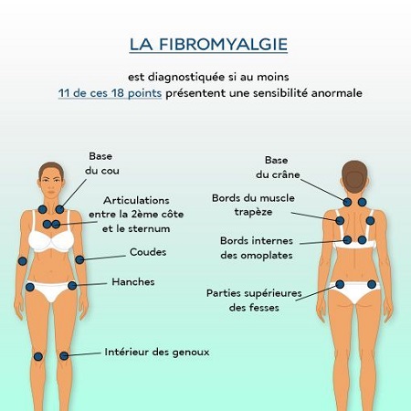 fibro-2 - Copie