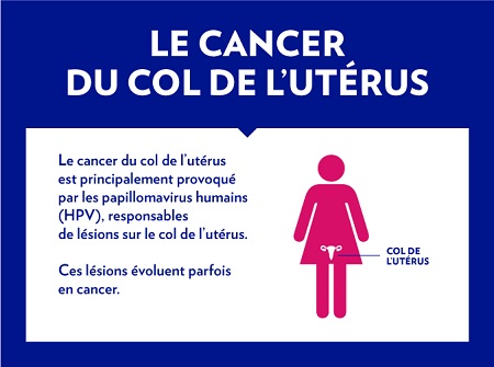 Infographie-Depistage-du-cancer-du-col-de-l-uterus-1